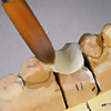 GP Dental Lab