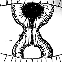 For Whom the Cell Tolls: Cancer Biology