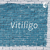 Vitiligo