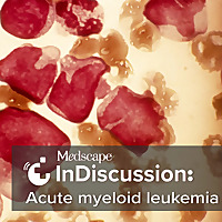 Medscape InDiscussion: Acute Myeloid Leukemia