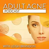 Adult Acne Podcast