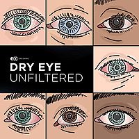 Dry Eye Unfiltered