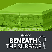 Beneath the Surface