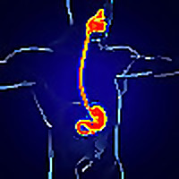 Navigating Gastrointestinal Challenges: Insight Into GERD and H. pylori Management