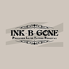 Ink-B-Gone Tattoo Removal Blog