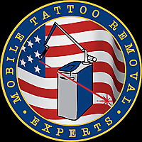 Mobile Tattoo Removal Experts Blog
