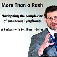 More Than a Rash - Navigating the complex world of Cutaneous Lymphoma