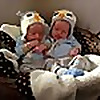 Monoamniotic Twins