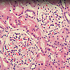 Washington University in St. Louis Nephrology Web Series