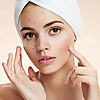 Acne Skin Tips