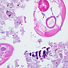PathologyNOW