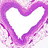 Pittsburgh Computational Pathology Lecture Series