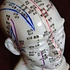 Guiding Needle Acupuncture