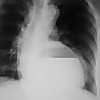 Radiology Residency UM/JMH