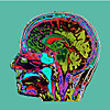 Headache School