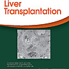 Liver Transplantation