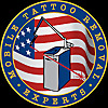 Mobile Tattoo Removal Experts Blog
