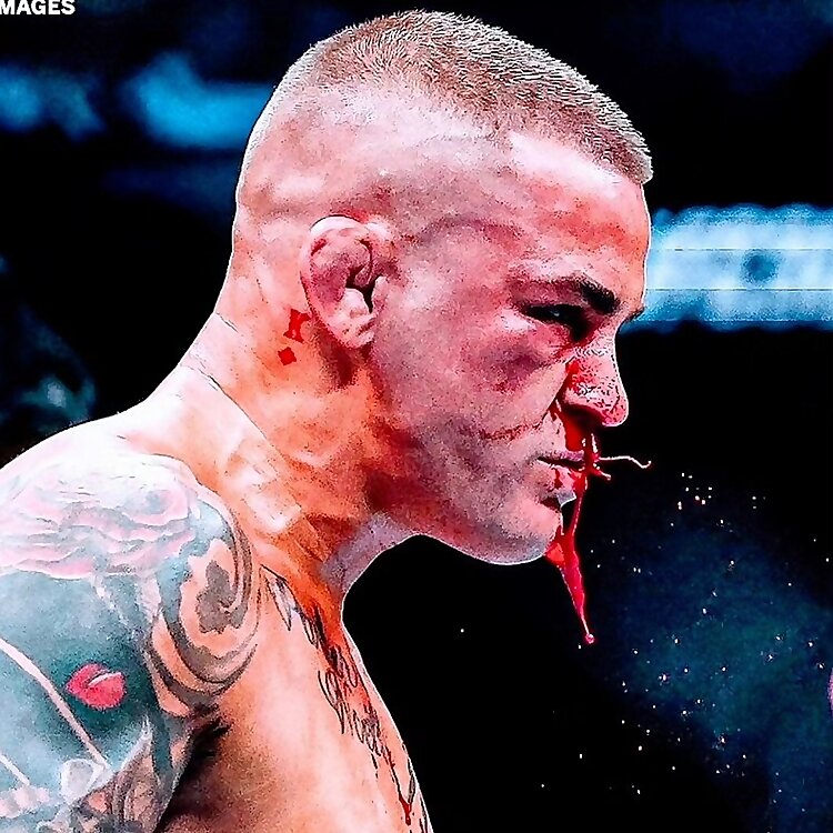 Dustin Poirier
