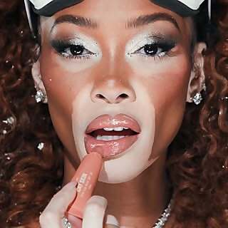Winnie Harlow