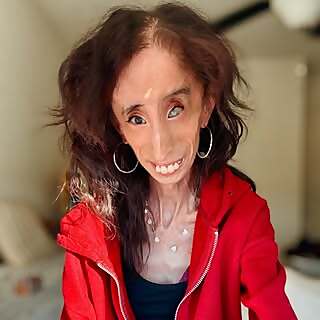 Lizzie Velasquez