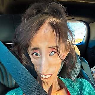 Lizzie Velasquez