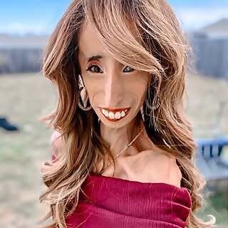 Lizzie Velasquez
