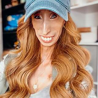 Lizzie Velasquez