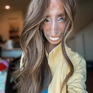 Lizzie Velasquez