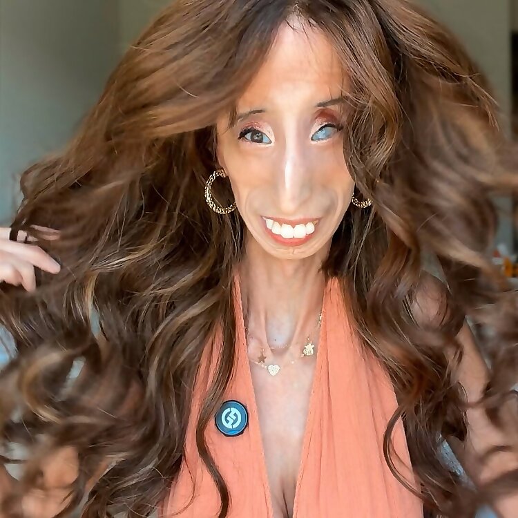 Lizzie Velasquez