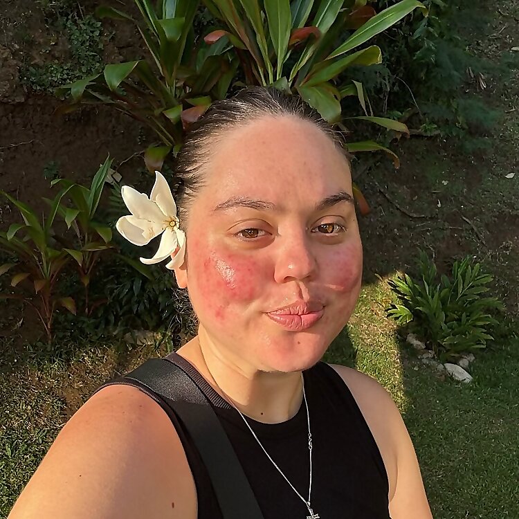 Girlwiththerosyredrash