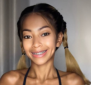 Benz 