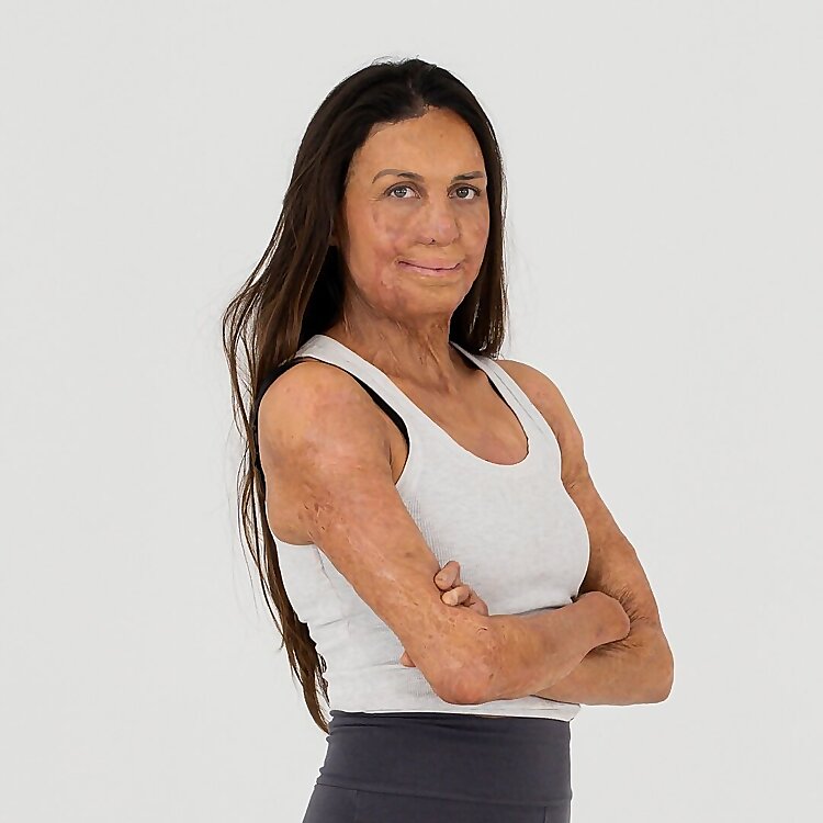 Turia Pitt